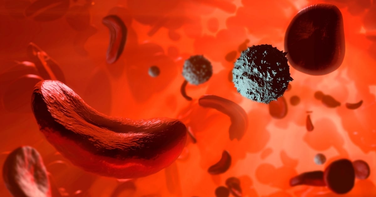 pain-diary-managing-sickle-cell-pain-crises-1