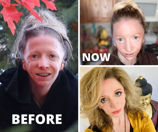 Before-and-After-Vegan-Plant-Based-Assuaged