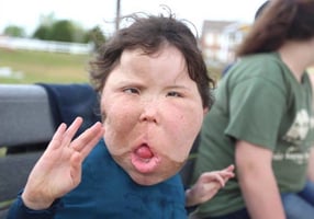 9 year old katie with megalencephaly waving hello