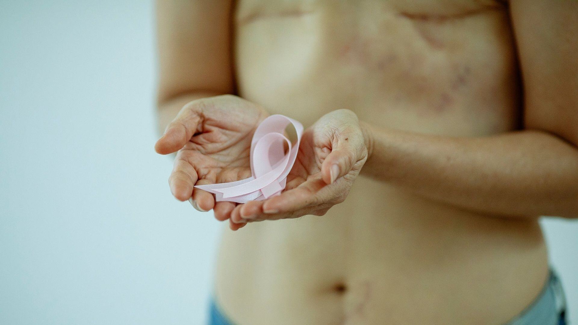 Assuaged-Blog-Masectomy-Breast-Cancer-Survival-Awareness-Image