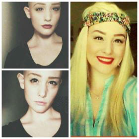 Amberlee-Nicole-Rasp-before-cccident-traumatic-brain-injury-recovery-assuaged