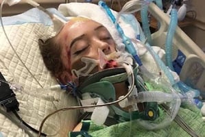 Amberlee-Nicole-Rasp-traumatic-brain-injury-recovery-assuaged-in-coma