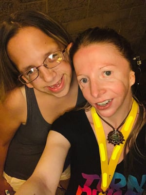 Friends Sherilee and Cynthia born with Treacher Collins Syndrome