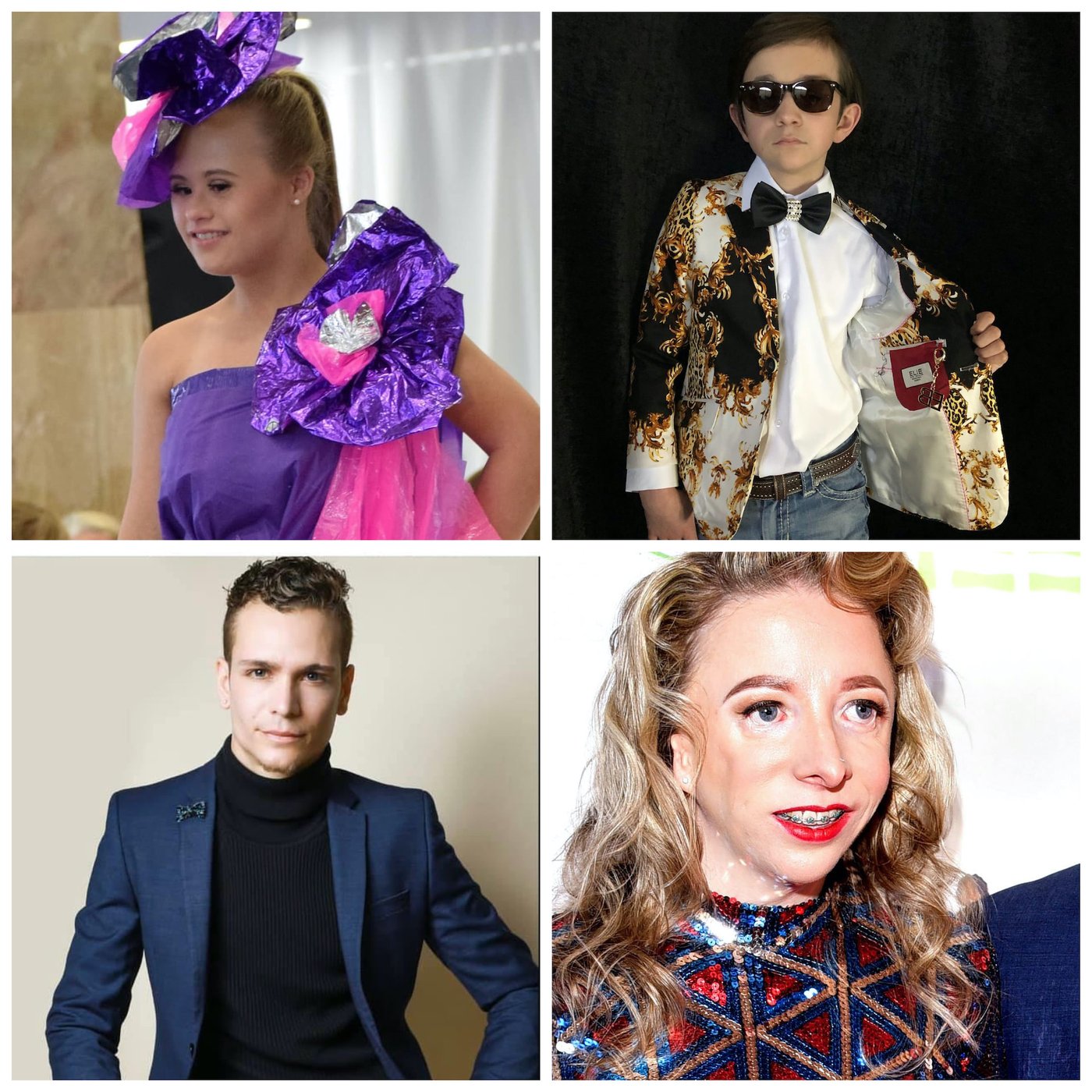 Kiss the Monkeys Once Upon a Runway FAO Schwarz Abigail Adams is an actress, model, and advocate with Down syndrome. Cynthia Murphy is a health activist and entrepreneur Treacher Collins Assuaged Weston Wright Blind Model Alexis German Beutel Deaf