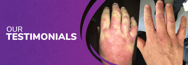 Homepage-Testimonials-Hands-Thane-Assuaged